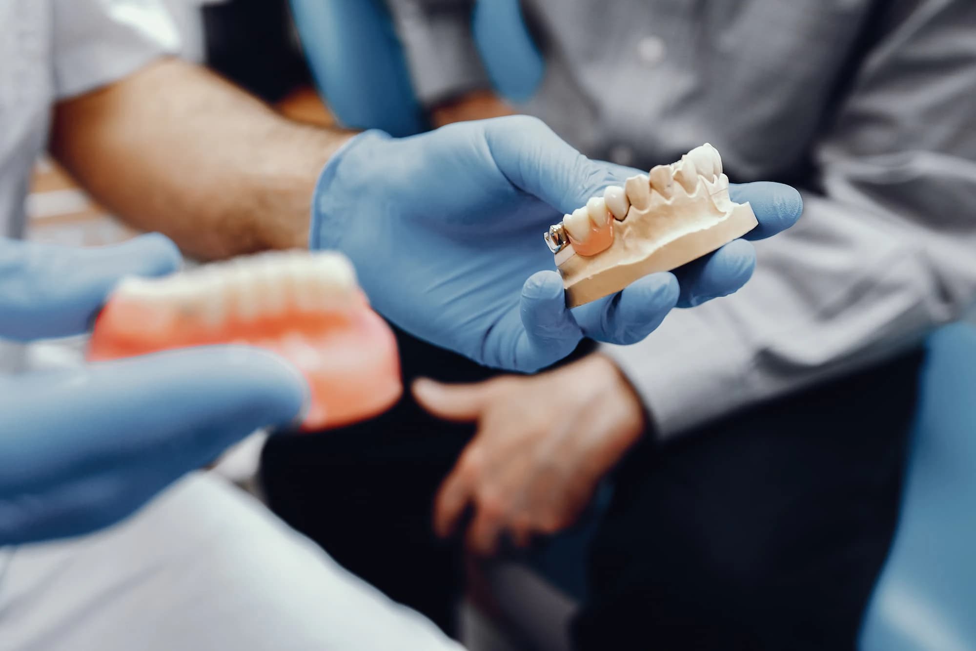 Modelos de prótesis dentales sostenidos con guantes